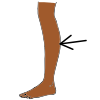 L+++++leg Picture
