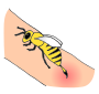 Bee Sting Picture