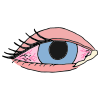 Pink Eye Picture