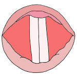 Vocal Folds Picture
