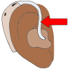 hearing+aid+tubing Picture