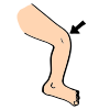 Put+your+knee+in Picture