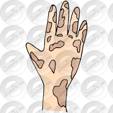 Dirty Hand