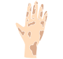 Dirty Hand