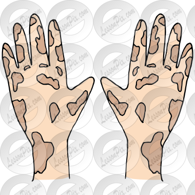 Dirty Hands