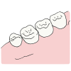 4+teeth Picture