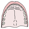 palate