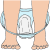 pads